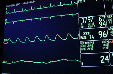 heart monitor